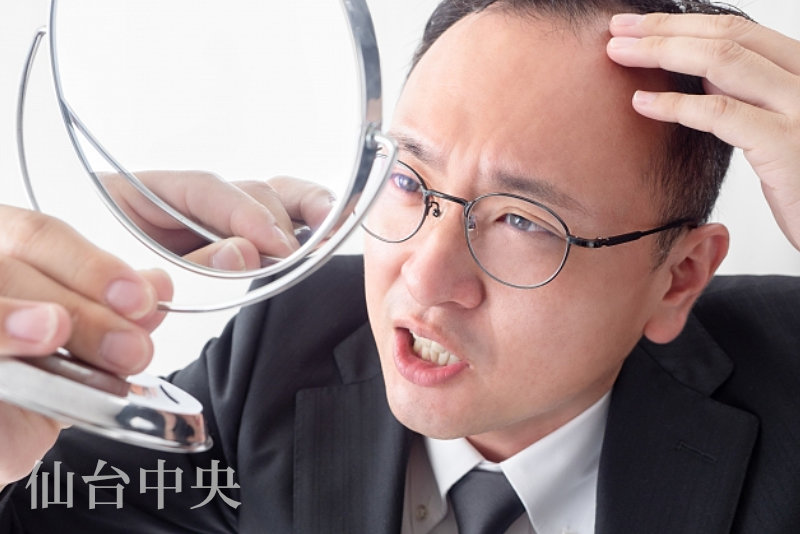 生え際の後退を嘆く男性