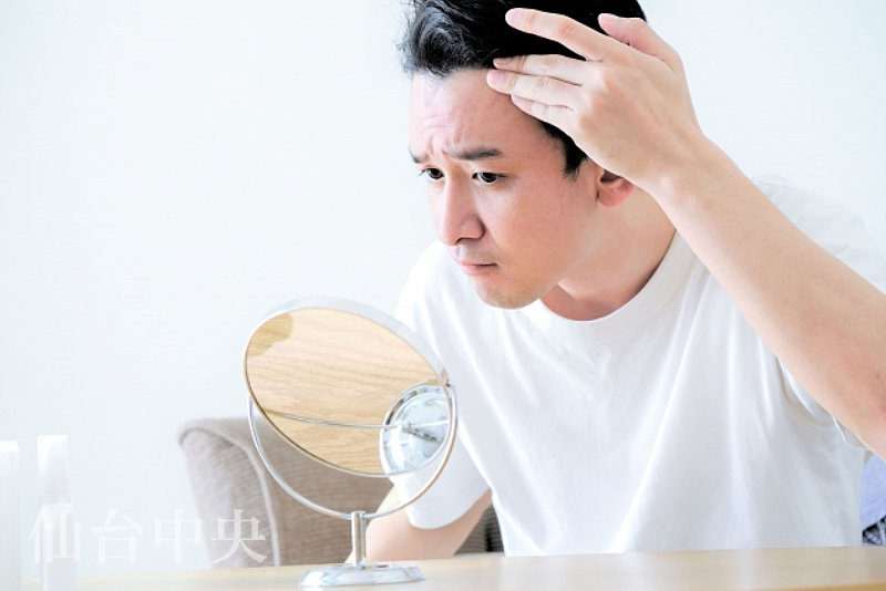 生え際の後退をチェックする男性