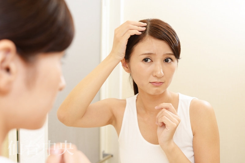 生え際薄毛に悩む女性
