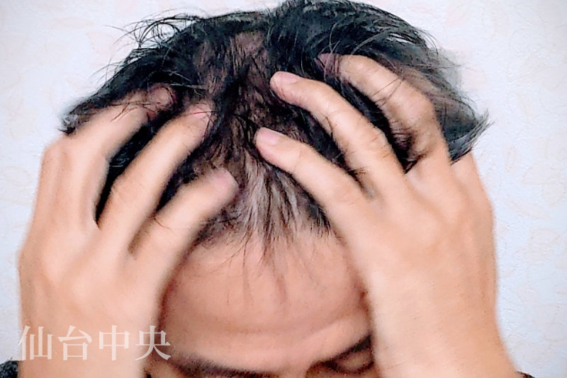 薄くなった前髪をかき上げる男性